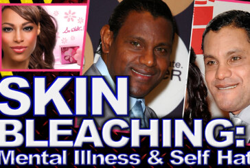 Skin Bleaching: Mental Illness & Self Hate! - The LanceScurv Show