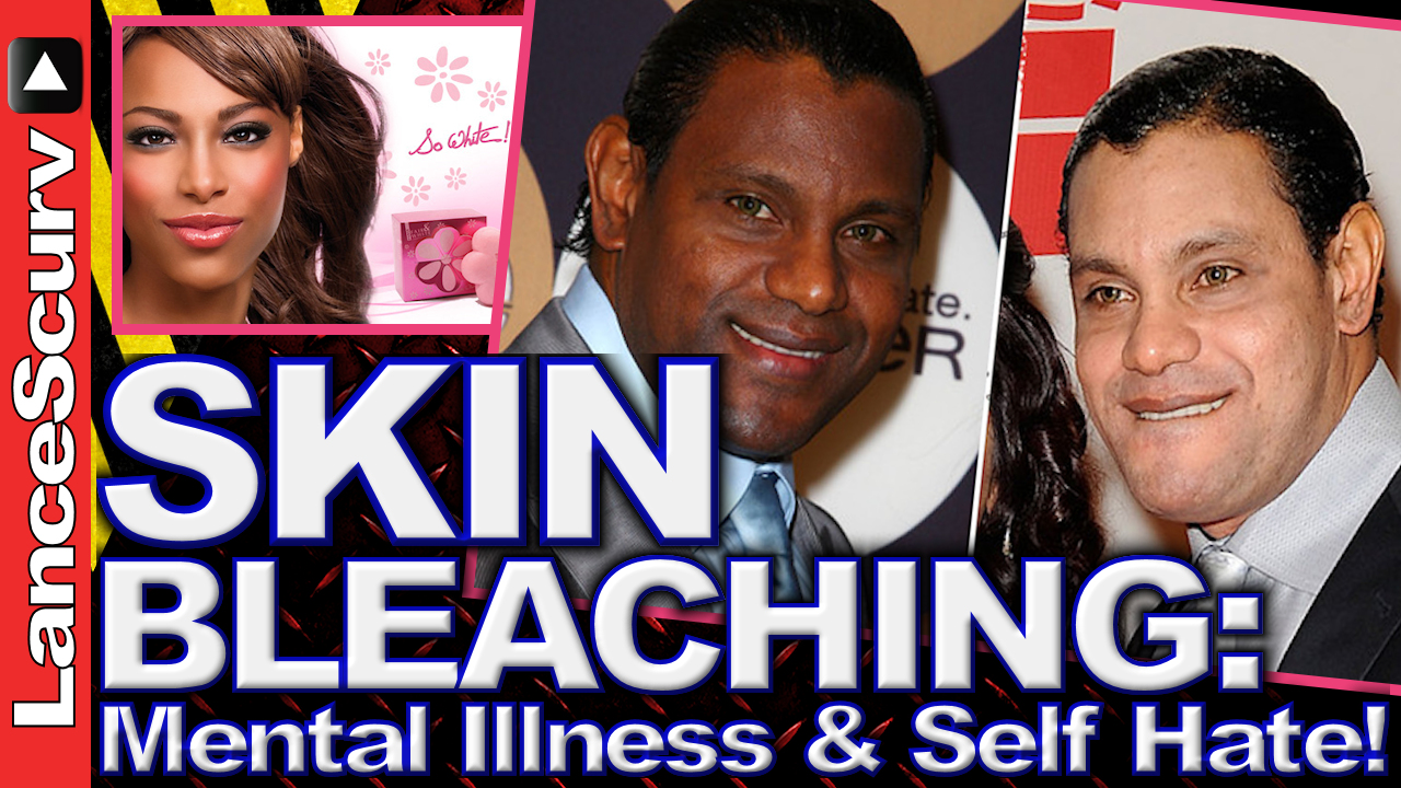 Skin Bleaching: Mental Illness & Self Hate! - The LanceScurv Show