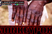 INTRODUCING MONKEYPOX: THE MEDIA FEARMONGERING & DISTRACTIONS CONTINUE!