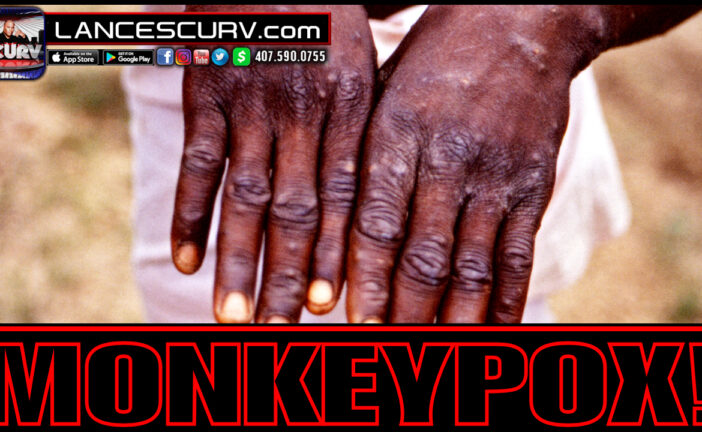INTRODUCING MONKEYPOX: THE MEDIA FEARMONGERING & DISTRACTIONS CONTINUE!